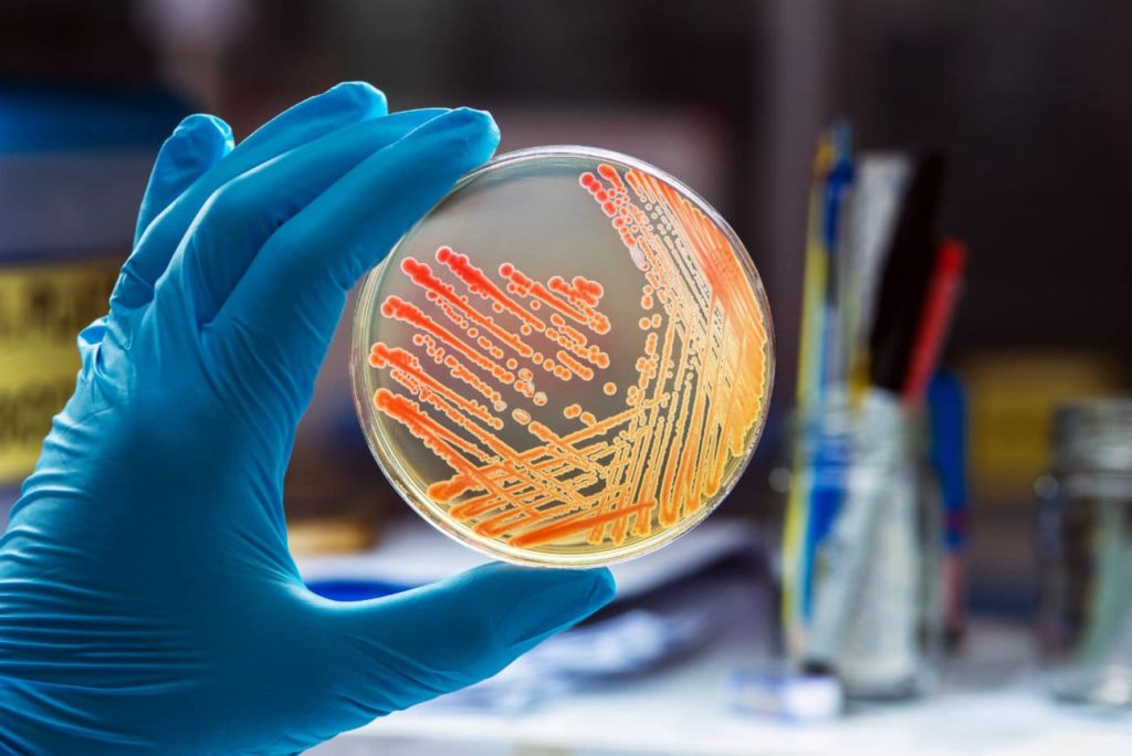 Colonies of bacteria growing on a Petri dish